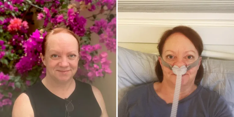 I Thought I Was Exhausted by My Life. It Was Sleep Apnea.