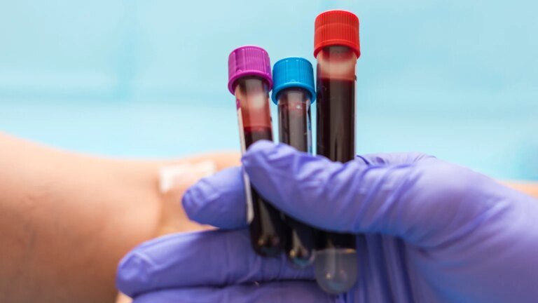Guardant Health Stock: An Expensive Price For A Great Company (NASDAQ:GH)