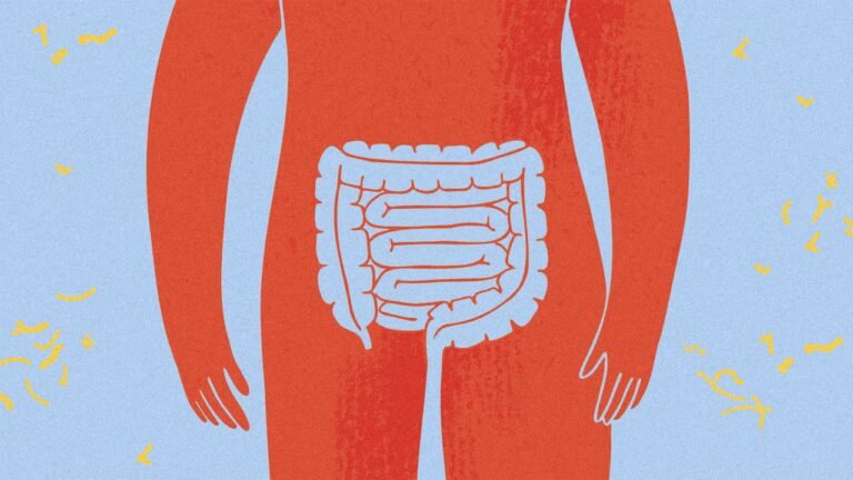 Why are healthy young adults getting colon cancer? Researchers may finally have a lead
